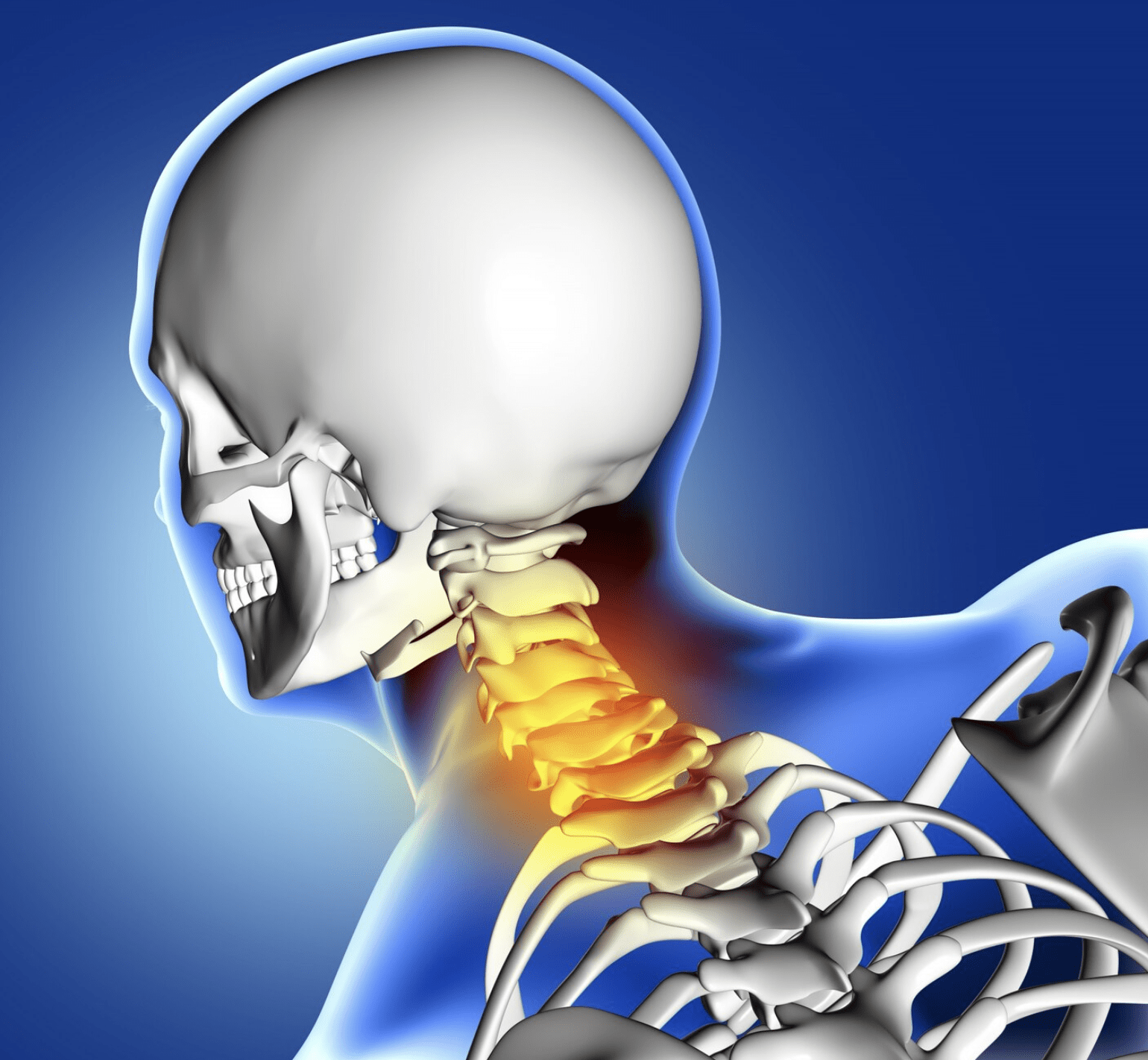 cervicalgia-causas-s-ntomas-y-tratamiento-sportsalud